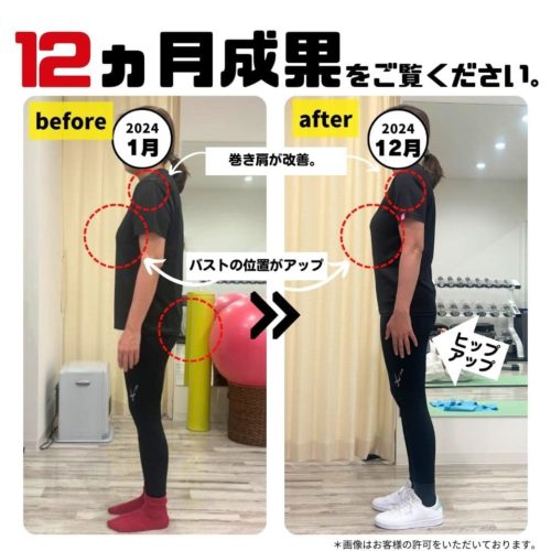 姿勢　美姿勢　姿勢改善　ビフォーアフター