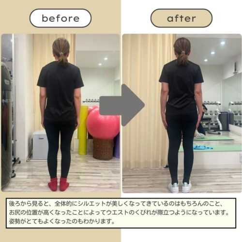 姿勢改善　巻き肩