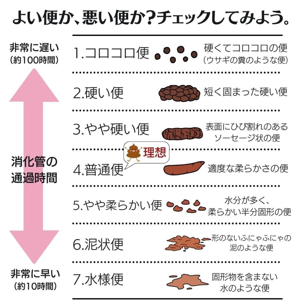 良い便か、悪い便か、うんちをチェックしてみよう。
