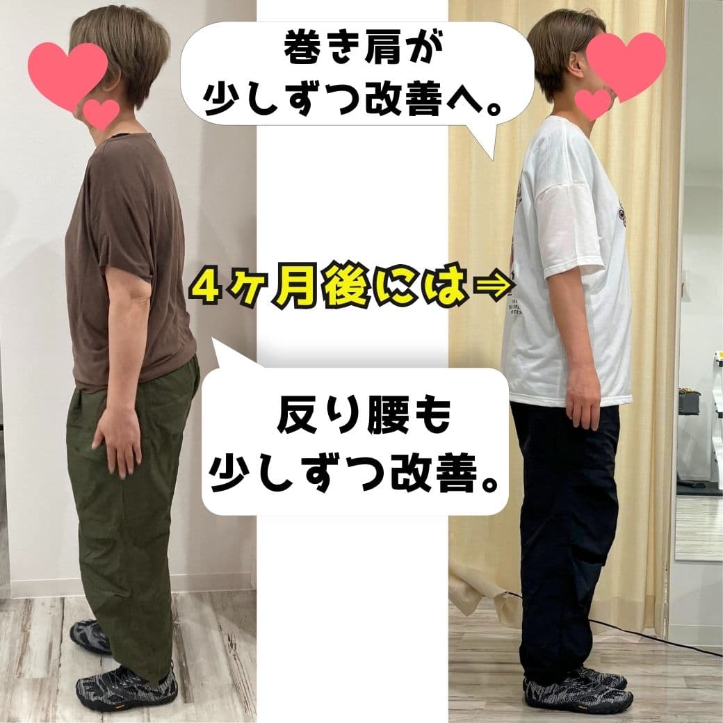 巻き肩 反り腰　改善