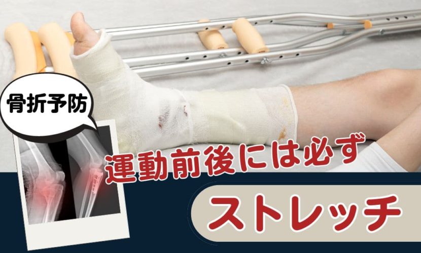 東京都の小池百合子知事 膝関節を剥離骨折