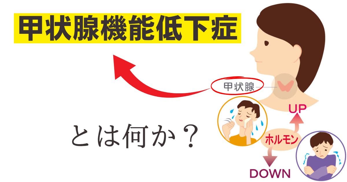 甲状腺機能低下症　橋本病