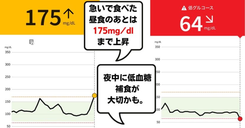 高血糖　低血糖
